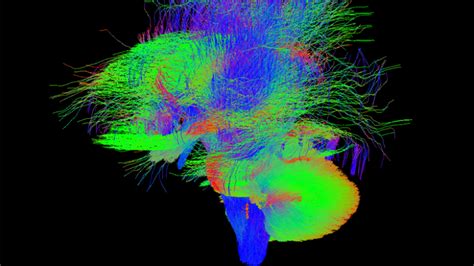 O­t­i­z­m­,­ ­Y­e­n­i­ ­G­e­l­i­ş­e­n­ ­M­R­I­ ­C­i­h­a­z­ı­ ­S­a­y­e­s­i­n­d­e­ ­S­o­n­a­ ­E­r­e­b­i­l­i­r­